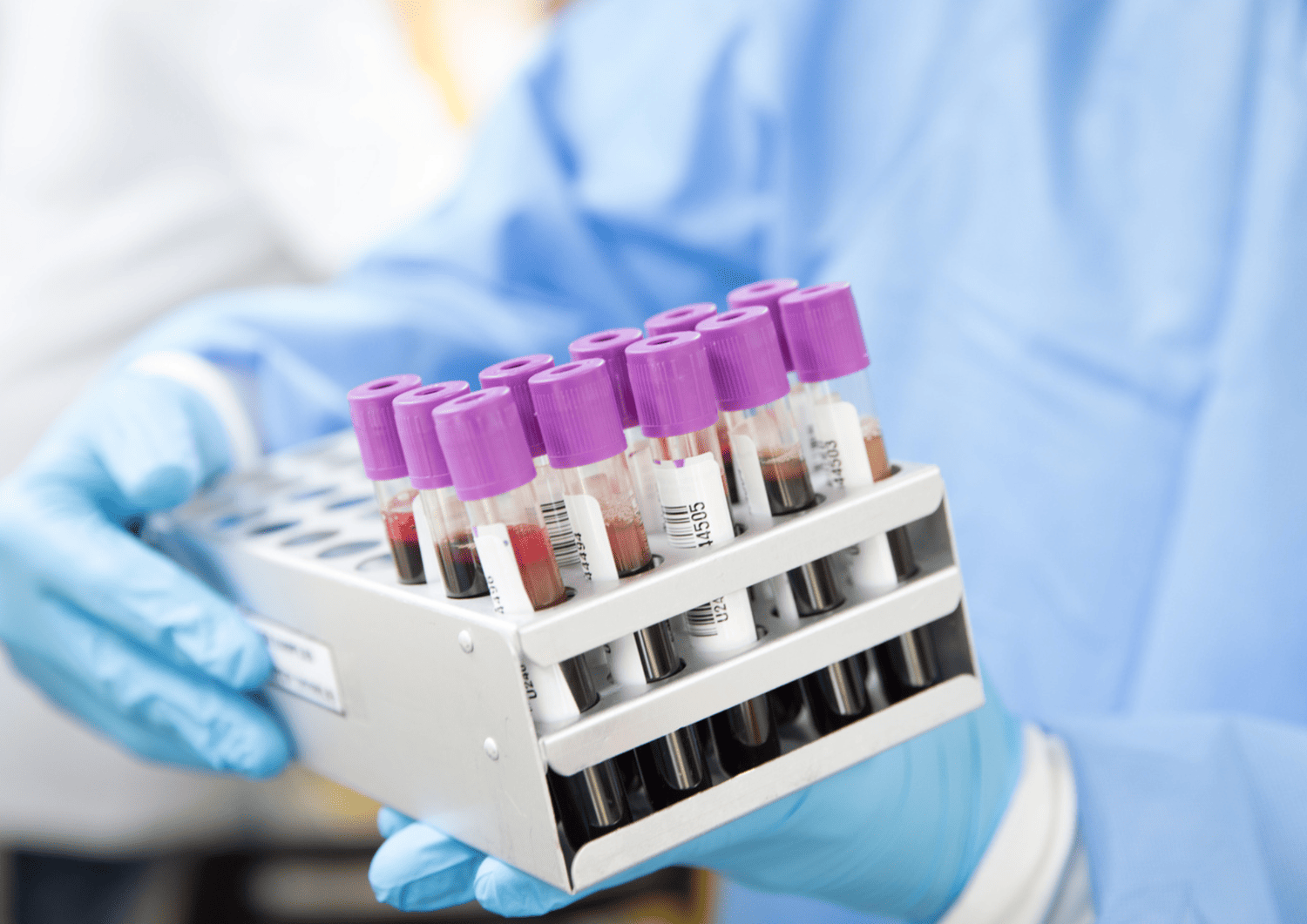 Lab technician handling blood samples in test tubes as part of Optima Medical’s in-house diagnostic lab services in Arizona.
